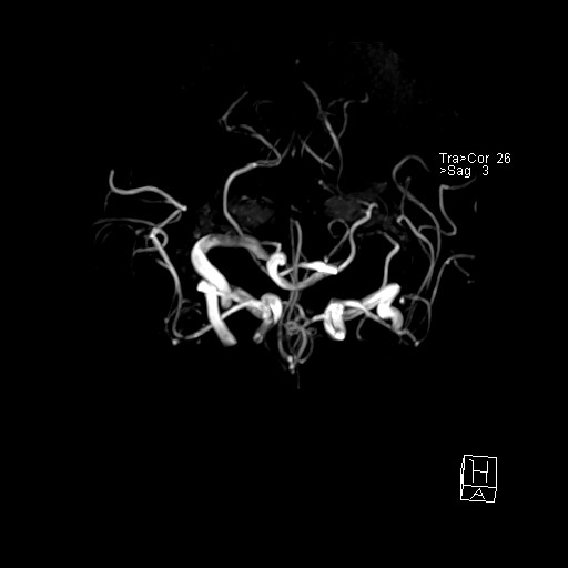 Click on the Serie image to view the images of VILLANUEVA, WILLIAM A.